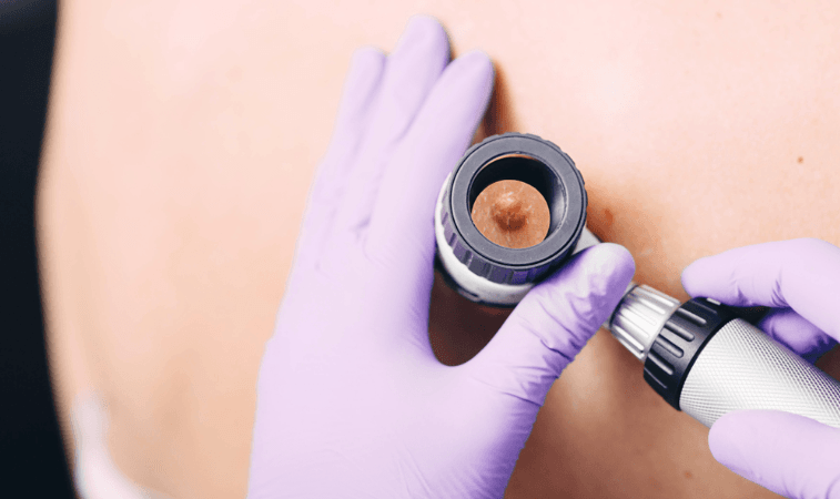 La dermatoscopie /la biopsie cutanée/ les sutures en médecine générale