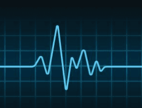 Electrocardiogramme pour les Médecins Généralistes